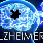 Alzheimers+Generic1
